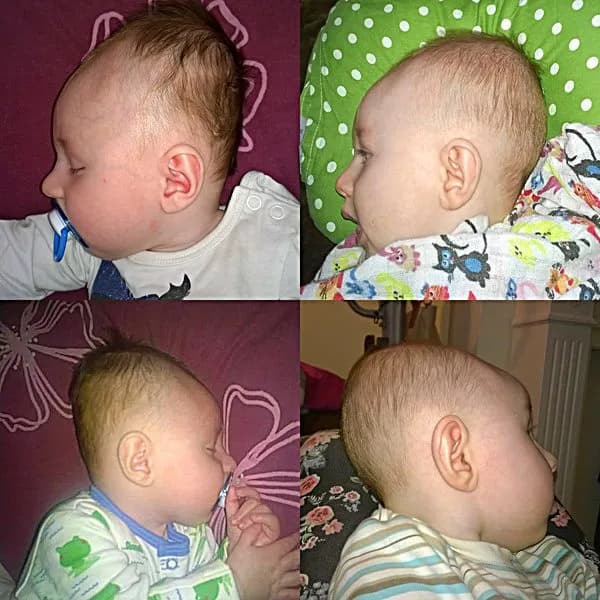 Poduszka Head Care: Kiedy zauważysz efekty i jak je przyspieszyć